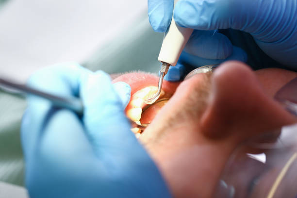 Best Emergency Gum Treatment in Colusa, CA